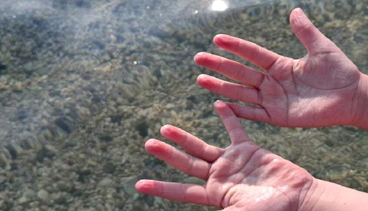 لماذا تتجعد أصابعنا في الماء؟.. تفسير طبي