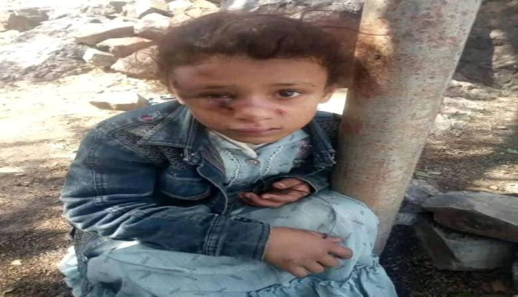 جريمة مروعة .. عم يعتدي على ابنة أخيه وأمها في هذه المحافظة!