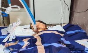 حضرموت ..إصابة طفلة بطلق ناري في حادثة عبث بالسلاح داخل منزلها