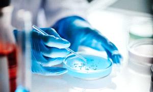 تطور علمي واعد في علاج اضطراب "عصبي نادر"