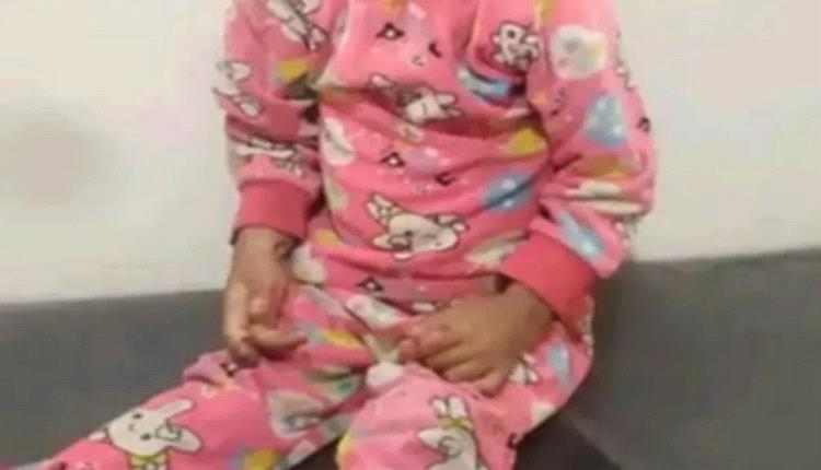 سكبت الجمر على رأسها .. تعذيب وحشي لطفلة على يد زوجة والدها تهز هذه المحافظة!
