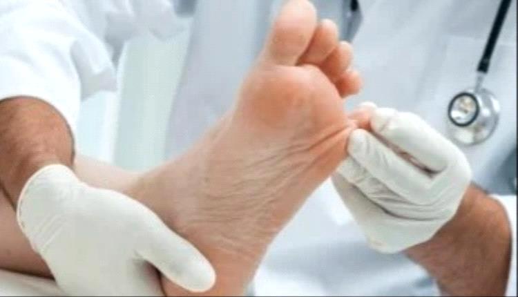 لماذا يجب اهتمام مريض السكر بقدميه.. علامات خطر
