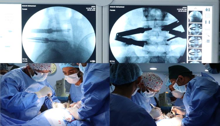 باستخدام تقنية التدخل المحدود .. إجراء عملية جراحية هي الأولى من نوعها في العاصمة عدن 
