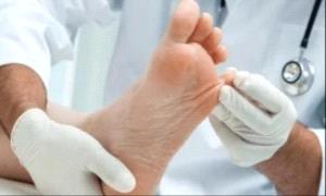 لماذا يجب اهتمام مريض السكر بقدميه.. علامات خطر

