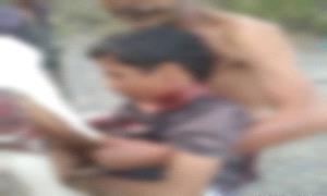 إصـ.ـابة طفل برصـ.ـاص قناصـ.ـة حـ.ـوثي في لحج