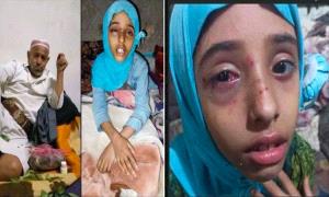 اعتداء وحشي على طفلة ووالدتها في إب 