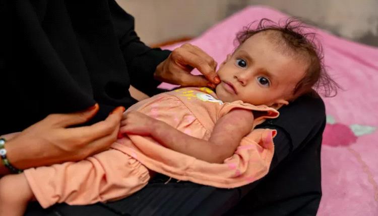 اليونيسف تطلق مبادرة تغذوية رائدة لتسريع الحد من نقص التغذية في اليمن