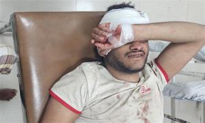 قناص حو/ثي يصيب شابًا شرق تعز
 