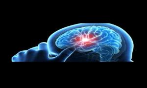 الدقيقة تحدث فرقا.. علامات مبكرة لجلطة المخ تلزم اللجوء للطبيب فورا!