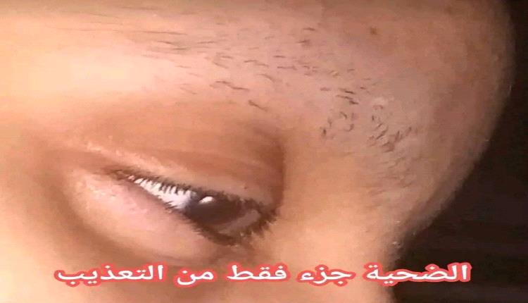 حلق شعرها وحواجبها ثم احـ.ـرقها .. محامي يعذّب زوجته بطريقة مـ.ـروعة هزت هذه المحافظة!