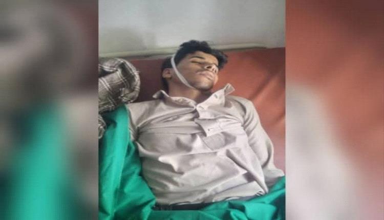 وفاة طفل في مركز أمني لمليـ.ـشيا الحو.ثي بحجة