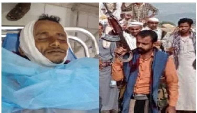 قيادي حـ.ـوثي يقـ.ـتل مواطناً تهامياً أمام أطفاله وهو يحمل لهم كيسًا من العنب