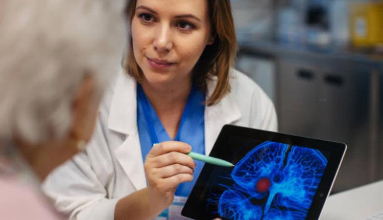 عادات يومية تزيد خطر الإصابة بالسكتة الدماغية