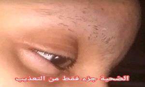 حلق شعرها وحواجبها ثم احـ.ـرقها .. محامي يعذّب زوجته بطريقة مـ.ـروعة هزت هذه المحافظة!