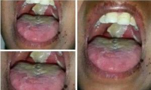 عقب تفشي مرض الدفتـ.ـيريا .. دعوات عاجلة لتفادي كارثة وبائية في هذه المحافظة!