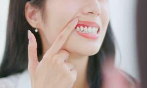 أمراض اللثة تزيد خطر تلف المادة البيضاء في الدماغ