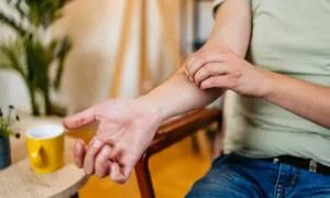 الحكة الجلدية قد تكون إنذارا مبكرا لأمراض الكلى