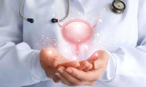 اختراق طبي جديد يقضي على سرطان المثانة