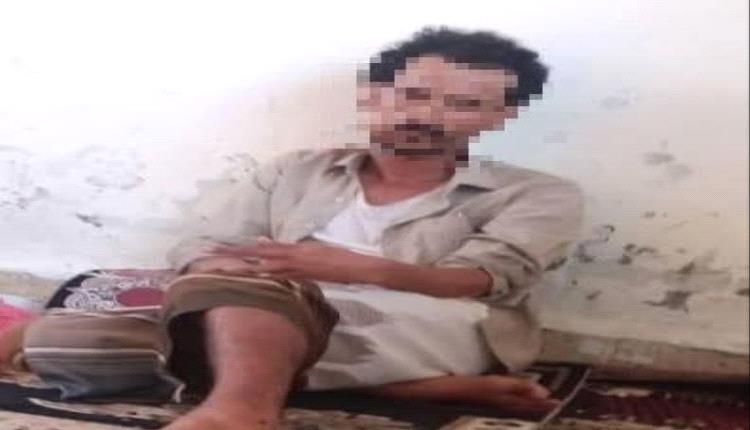 شرطة شبوة تضبط شخص متورط في عمليات نصب واحتيـ.ـال واسعة النطاق بمحافظتي عدن ولحج .