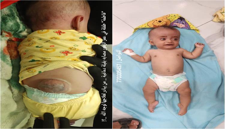 ”فاطمة” طفلة في عمر الزهور مصابه بقيلة دماغية .. من يبادر لعلاجها لوجه الله ..؟