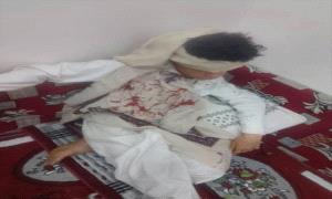 اقتـ.ـلاع عينيه وكسـ.ـر جمجمته .. قيادي كبير يعتدي على طفل في جريمة وحشية هزت هذه المحافظة!