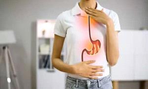 وضعية النوم ليست الحل.. إليك سر تقليل حموضة المعدة
