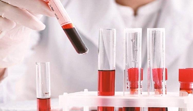 روسيا تطور شريحة ذكية لتحليل الدم ميدانيا بشكل فوري