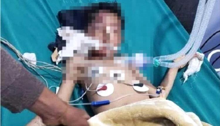 حادث انقلاب مركبة يصيب أسرة من إب 