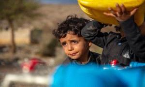 اليونيسف: السمنة تتجاوز لأول مرة نقص الوزن بين الصغار في العالم