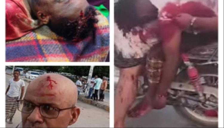 الشبكة المدنية تدين استخدام الرصـ,ـاص الحي ضد متظاهرين سلميين في المكلا وسقوط شهـ,ـداء وجـ,ـرحى
