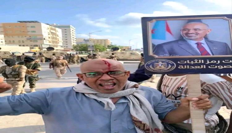 بيان الردة: حين يغسل الخونة عارهم بـ.ـدم الضحايا