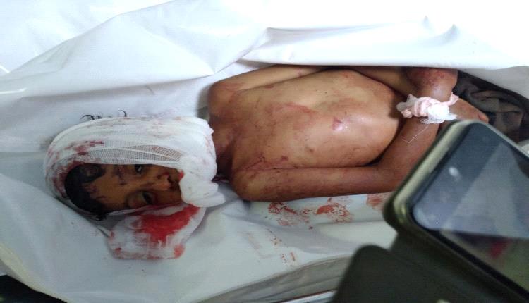 جريـ.ـمة أسرية تتحول إلى مأساة مزدوجة في الضالع وسقوط طفل قتـ.ـيل