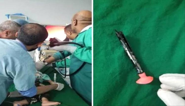 إنقاذ طفل بعد 14 يوماً بجسم غريب داخل جسده" تفاصيل"

