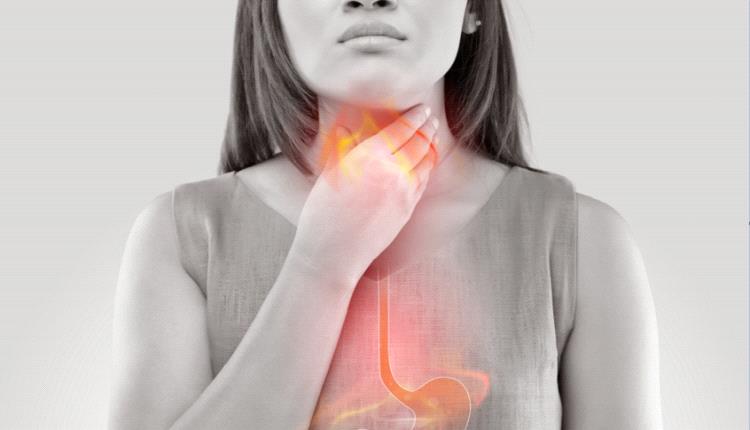 نصائح عملية بسيطة للتخفيف من حرقة المعدة