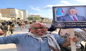 بيان الردة: حين يغسل الخونة عارهم بـ.ـدم الضحايا