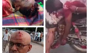 الشبكة المدنية تدين استخدام الرصـ,ـاص الحي ضد متظاهرين سلميين في المكلا وسقوط شهـ,ـداء وجـ,ـرحى
