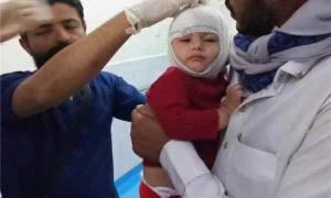 وزير الصحة يعلن حصيلة جديدة لضحايا القصف الحو.ثي على مأرب