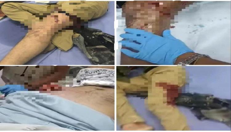 محاولة لتجريم تأييد المجلس الانتقالي.. حقيقة مرة وراء حملات القمع ضد الجنوب