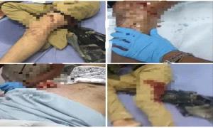 مصادر طبية : ارتفاع ضحايا استهداف المتظاهرين إلى 17 جريحاً