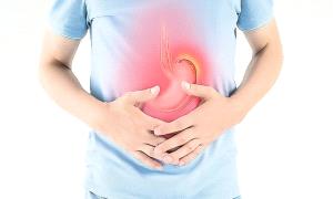 كيف تتجنب حرقة المعدة وارتجاع المريء خلال رمضان؟