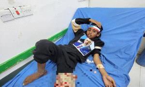 إرم نيوز :  الرصـ.ـاص يقمع المحتجين.. مَن المستفيد من دمـ.ـاء شبوة ؟