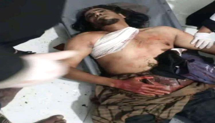 نقطة أمنية بتعز اليمنية تطلق الـ.ـنار على صاحب دراجة نارية .. والشرطة العسكرية في التربة تبتز السائقين