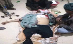 قتـ.ـيل وجريحان في حوادث عنـ.ـف متفرقة بإب وذمار وسط انفلات أمني متواصل