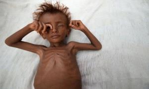 اليمن تتصدر قائمة الدول الأكثر معاناة من انعدام الأمن الغذائي