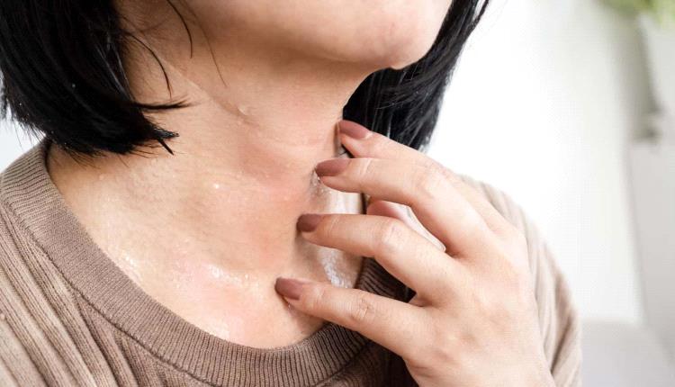 مع ارتفاع درجات الحرارة.. كيف تقي نفسك من الأمراض الجلدية الشائعة صيفا؟