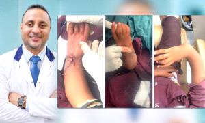 إنجاز طبي غير مسبوق.. جراح يمني في عدن ينهي معاناة طفل من تشوه خلقي معقد بعد 13 عاماً من المعاناة