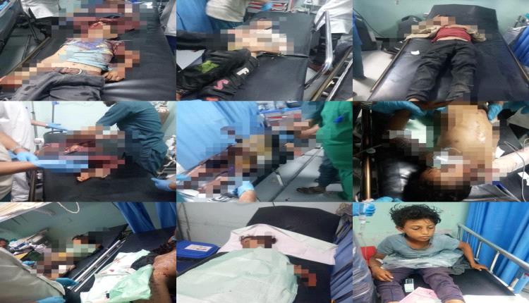 محافظ الضالع يوجه باستنفار طبي شامل لإنقاذ ضحايا انفجـ,ـار مخلفات الحـ,ـوثي في حجر