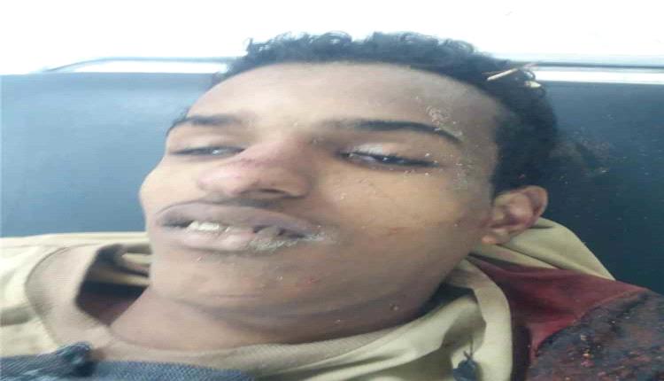 مقـ,ـتل شاب برصـ,ـاص مسـ,ـلح في سوق منطقة المحلة بمحافظة لحج