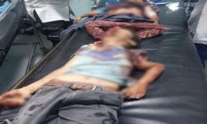 دماء الطفولة في الضالع.. الجنوب يدفع ضريبة الصمود في وجه الإرهـ.ـاب الحـ.ـوثي