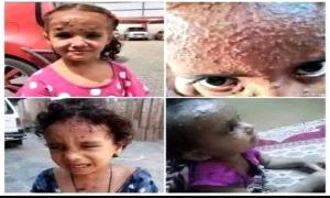 عدن..عندما يتحول الصيف فيها إلى عقاب جماعي..!
